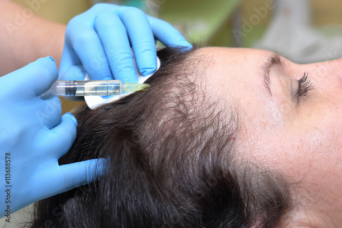Anti hair loss injection in clinic.
