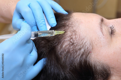 Anti hair loss injection in clinic.