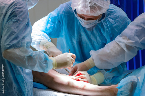 surgeon making phlebectomy