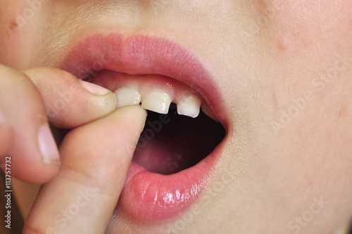 baby teeth check jiggle test 