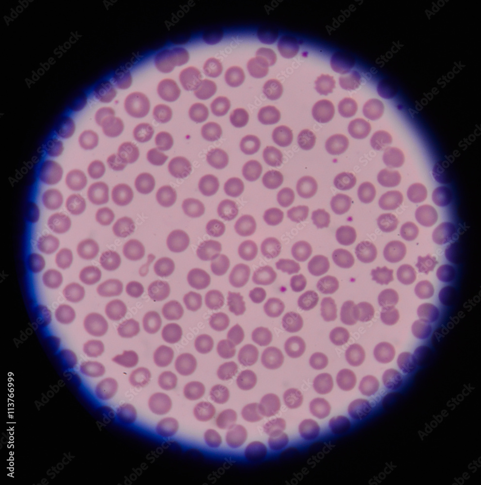 Blood test for Complete Blood Count. CBC Stock Photo Adobe Stock