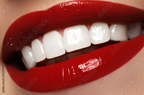 Canvas Print Perfect smile after bleaching. Dental care and whitening teeth