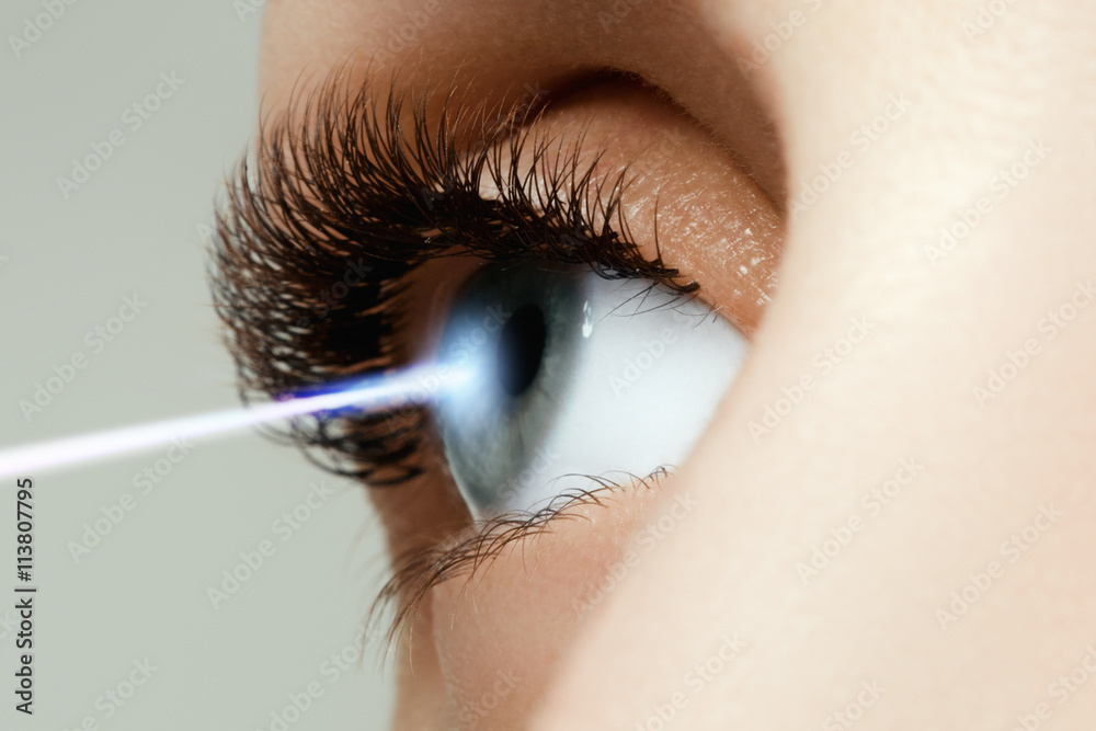 © looking2thesky - Laser vision correction. Woman's eye. Human eye