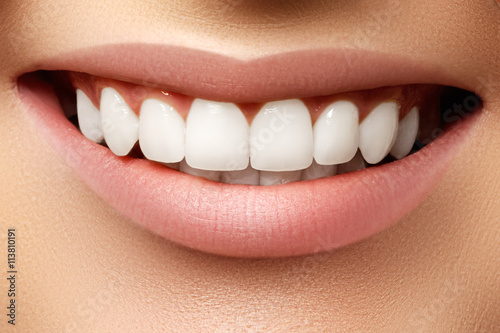 Beautiful smile of young fresh woman with great healthy white teeth
