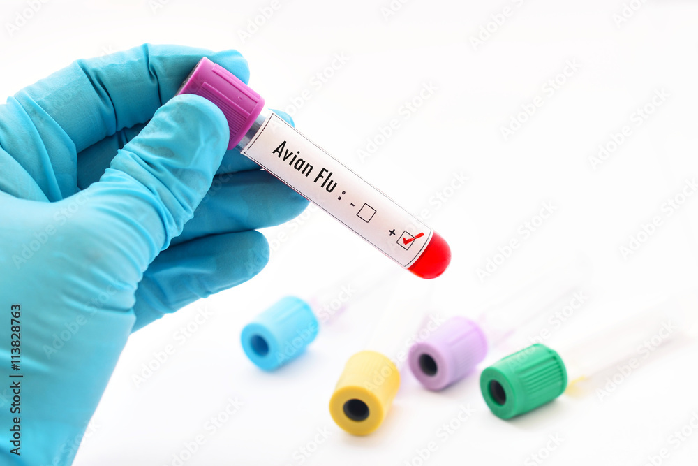 Naklejka premium Avian Flu positive