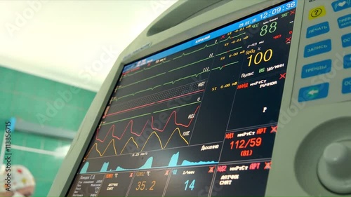Medical monitor computer with indications of human heart activity