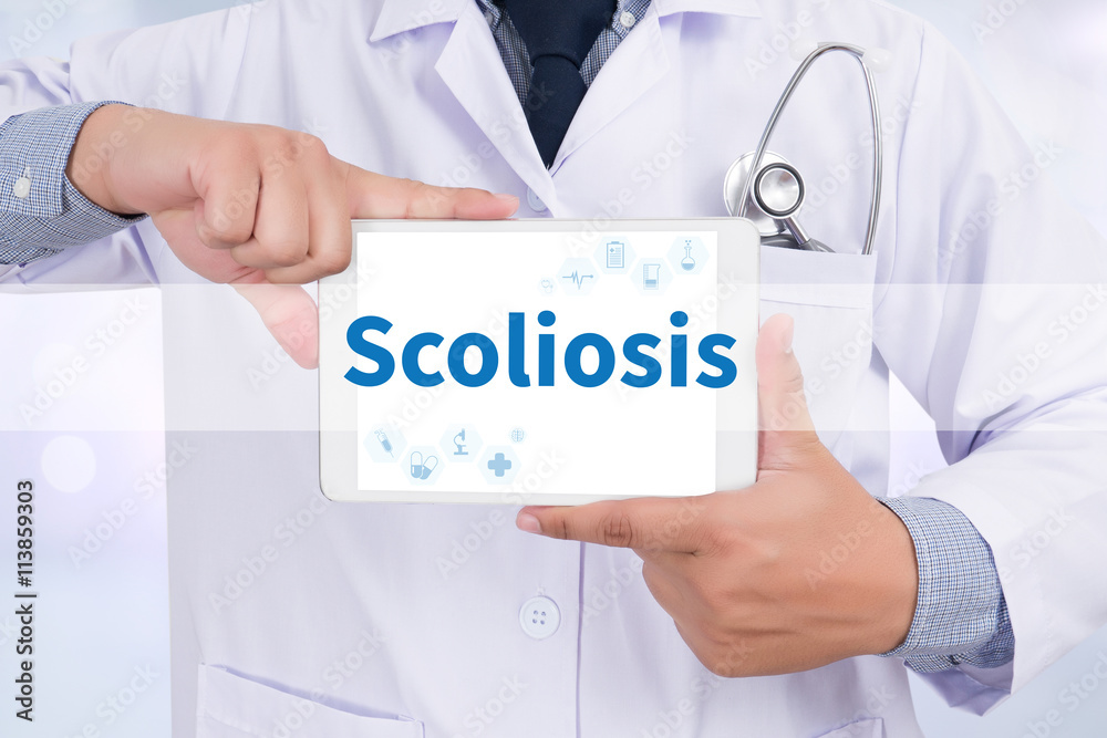 Scoliosis Scoliosis