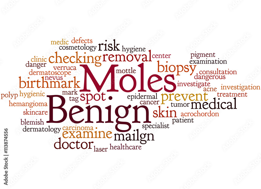 Benign Moles, word cloud concept 2 Stock Illustration | Adobe Stock