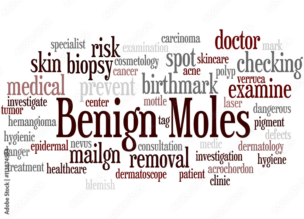 Benign Moles, word cloud concept 3
