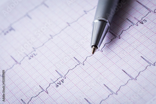 Quadro su tela cardiogram and technical pen