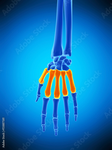 medically accurate illustration of the metacarpals bones photo