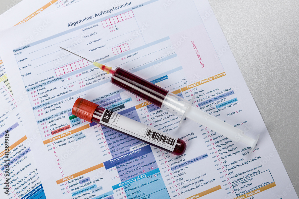 Blutprobe, Spritze und Analyseformular