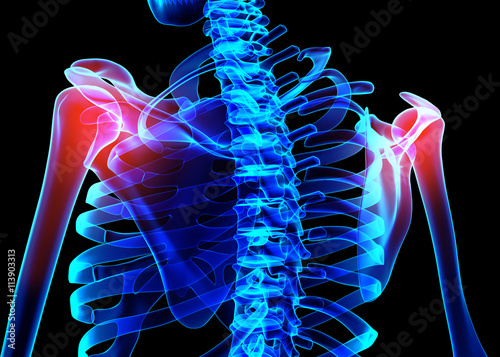 Shoulder painful skeleton x-ray, 3D illustration.