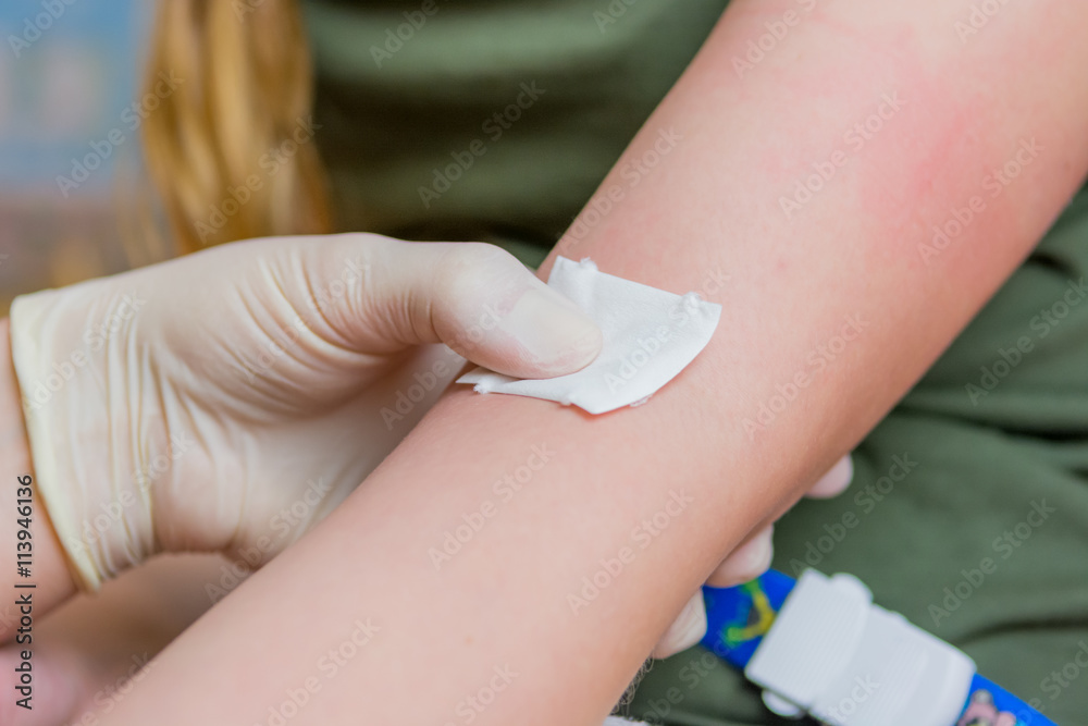 blutabnahme im armgelenk blutabnahme im armgelenk
