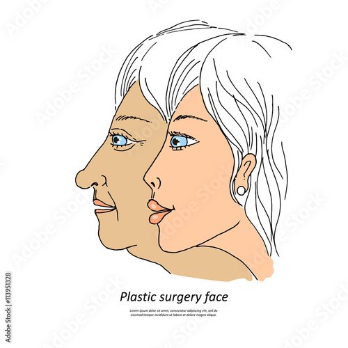 Plastic surgery face1