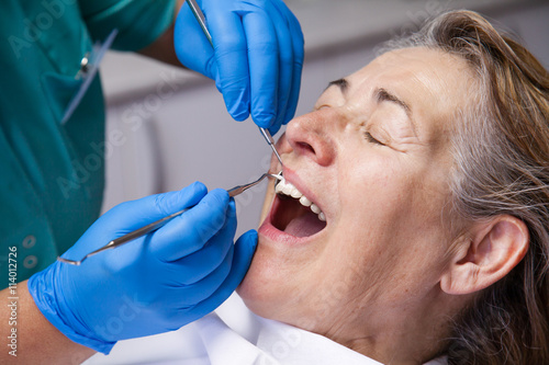 treatment of gingivitis at the dentist photo