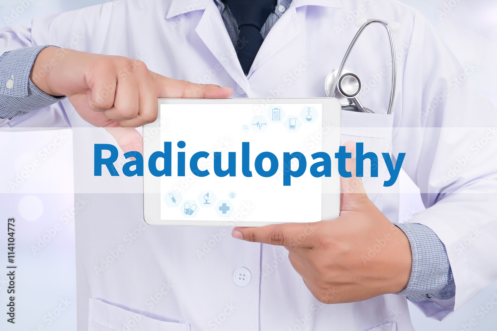 Radiculopathy Radiculopathy