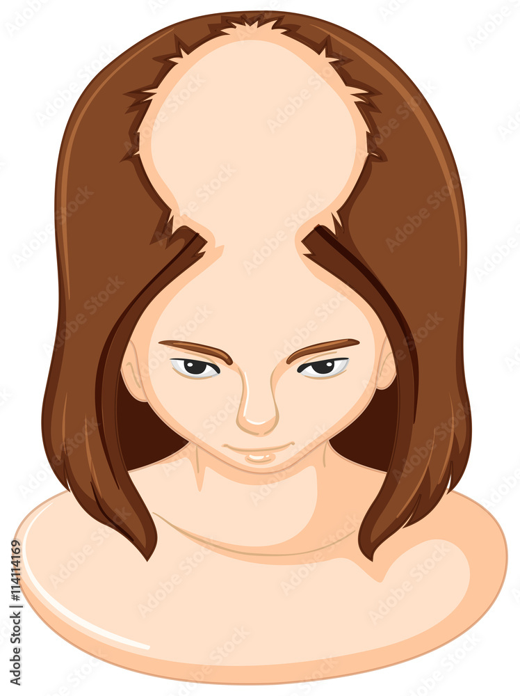 Woman lossing a lot of hair Woman lossing a lot of hair