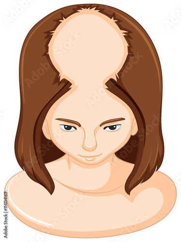 Woman lossing a lot of hair