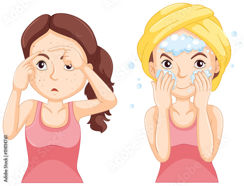 Woman washing face and woman with pimples