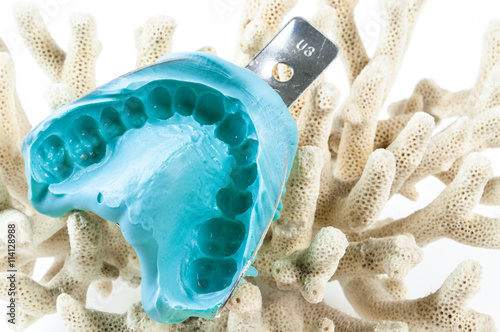 dental impression