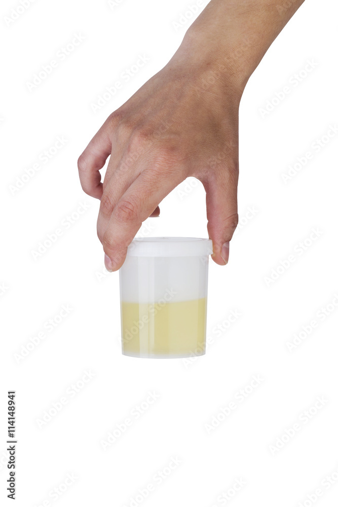 jar of urine jar of urine