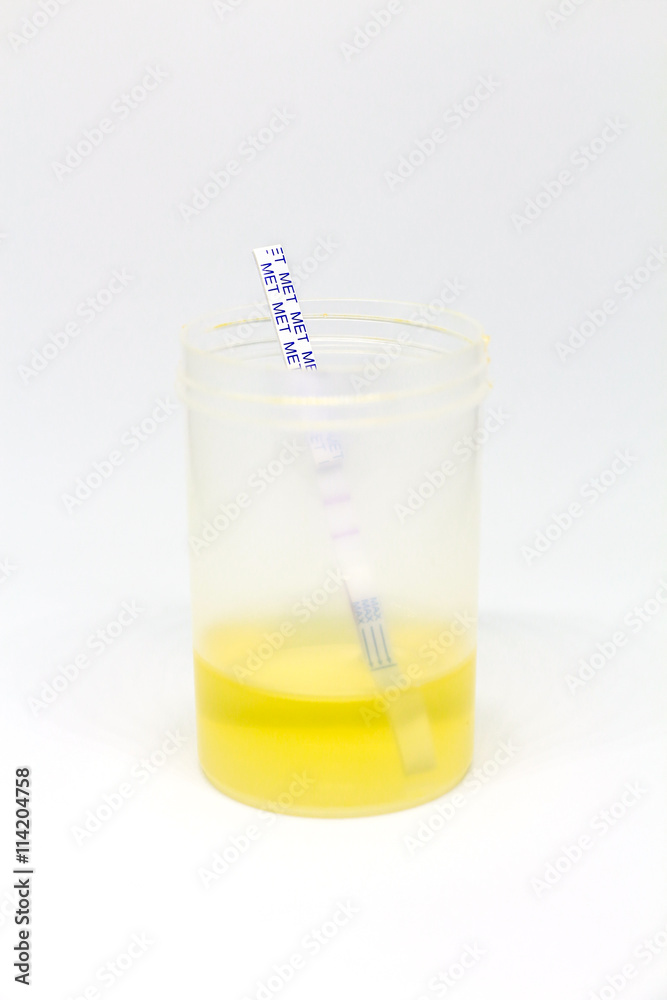 Detection of methamphetamine in urine by using test card Detection of methamphetamine in urine by using test card