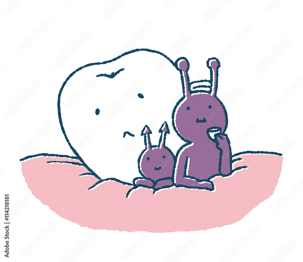 虫歯菌に場所をとられる歯 Stock イラスト Adobe Stock