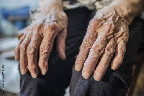 wrinkled hands of an elderly woman on her knees