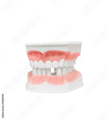 Dental Model of Teeth , and broken tooth , Isolated on white background clipping path