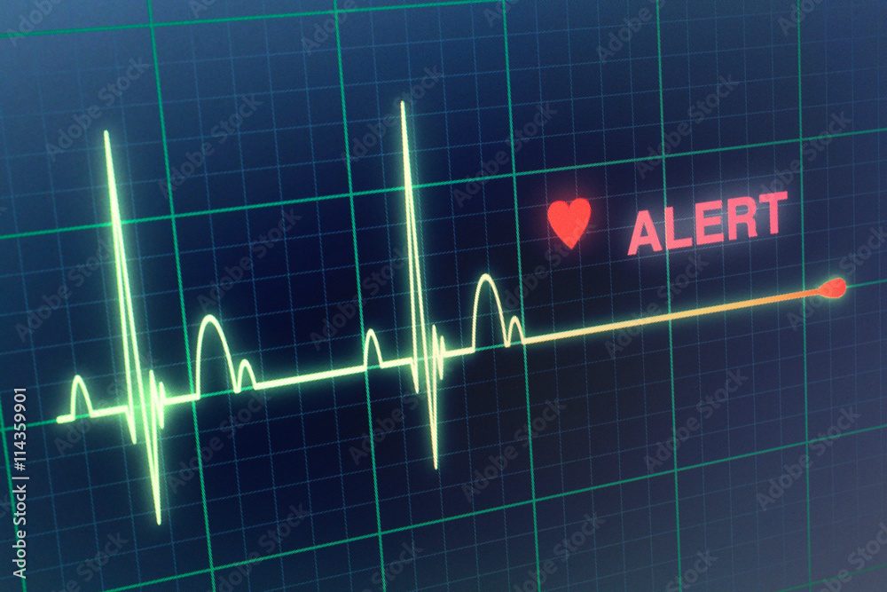 Naklejka premium Heart beats cardiogram on the monitor.