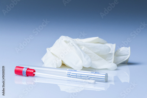 DNA Wisch Test, Mundabstrich, COVID-19