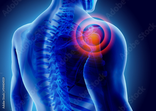 3D Illustration of shoulder painful. photo