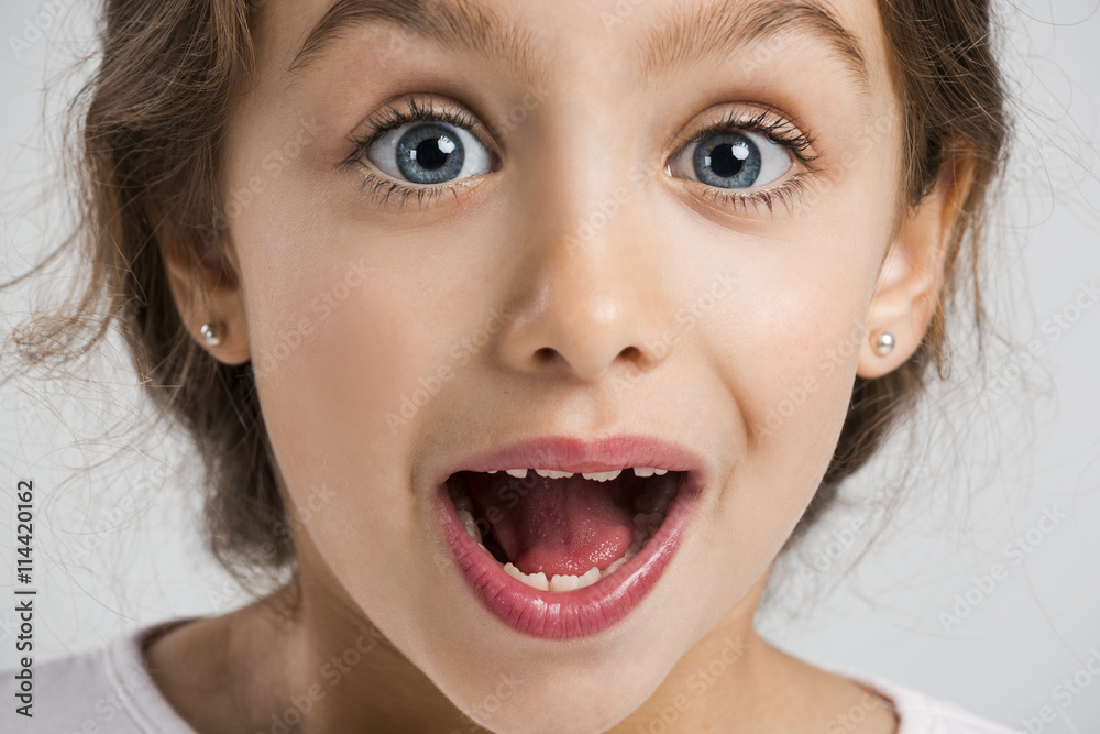 Surprised girl Surprised girl