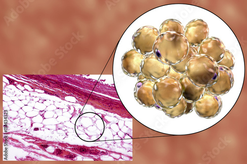 White adipose tissue, light micrograph and 3D illustration, hematoxilin and eosin staining, magnification 100x. Fat cells (adipocytes) have large lipid droplet which remains unstained photo