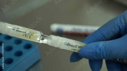The doctor prepares the semen donor sperm for freezing
