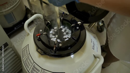 Freeze donor seminal fluid in liquid nitrogen. The machine for sperm freezing