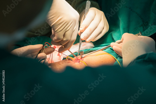 vascular surgery