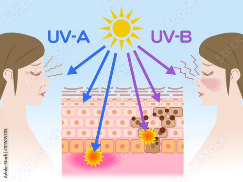 mechanism of sunburn and aging of the skin