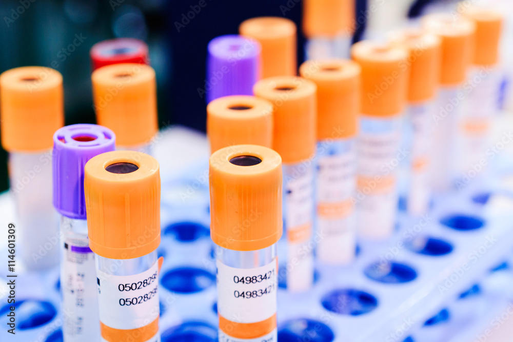 Test tubes for blood. Medical equipment. Test tubes for blood. Medical equipment.