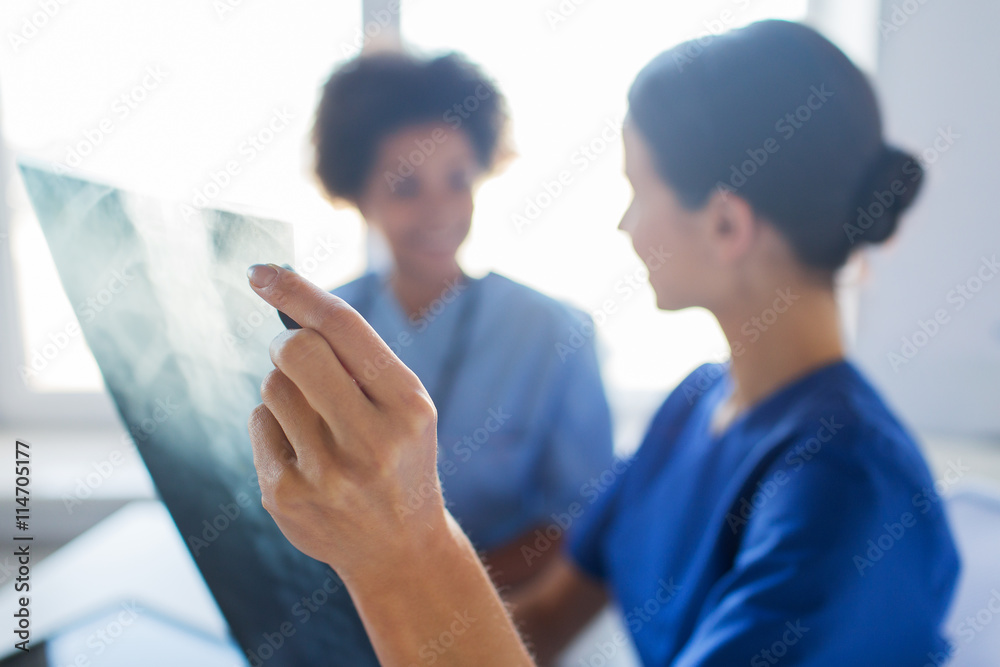 close up of doctors with x-ray image at hospital close up of doctors with x-ray image at hospital