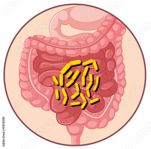 Bacteria in human stomach