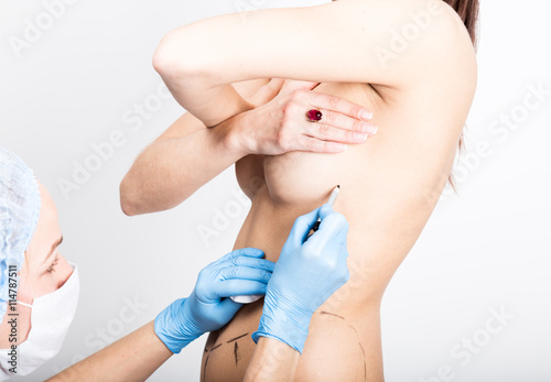 Female doctor makes dotted line on female body for cellulite correction. cosmetic surgery. lifting and breast augmentation