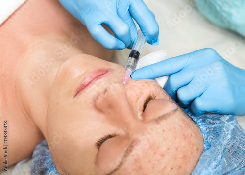 Beautician makes biorevitalization to young woman. The cosmetic procedures for the face. Beauty treatments in the spa salon. Facial Skin Care