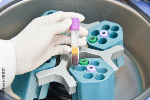 technician placing blood tubes in the laboratory centrifuge