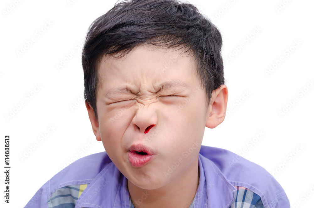 Young Asian boy with bleeding from nose over white Young Asian boy with bleeding from nose over white