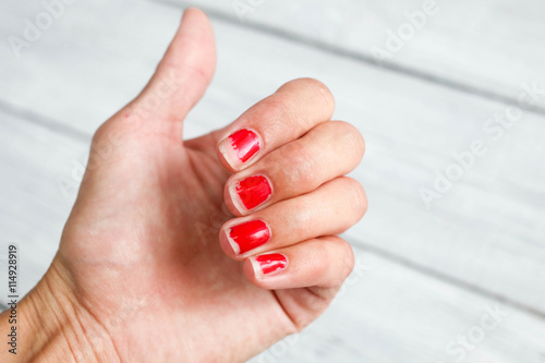 Cuadro en lienzo Ugly nails with a bare red varnish