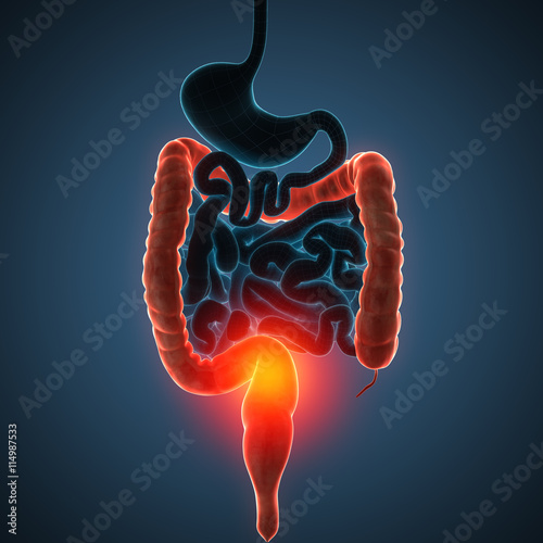 intestines disease illustration