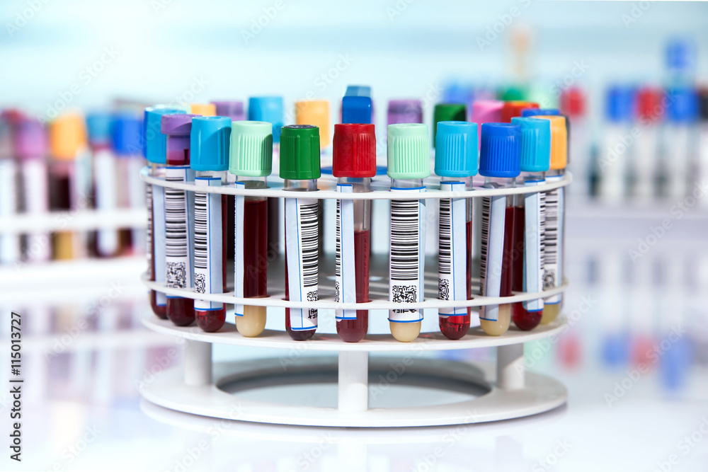 Φωτογραφία blood tubes with labels in circular tray / tubes prepared for centrifuge machine