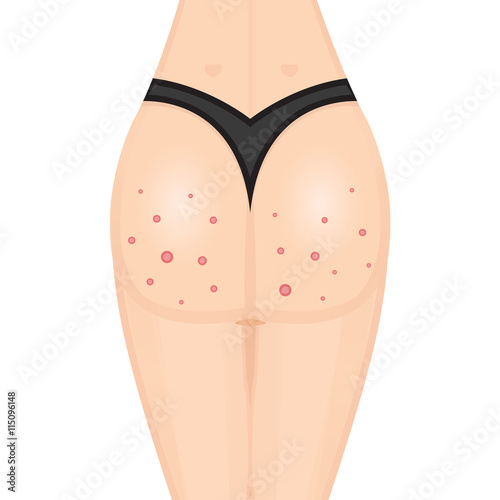 Buttocks, breech, butt, rear, nates icon or logo